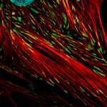 iacs_sct_microscopia-150×150