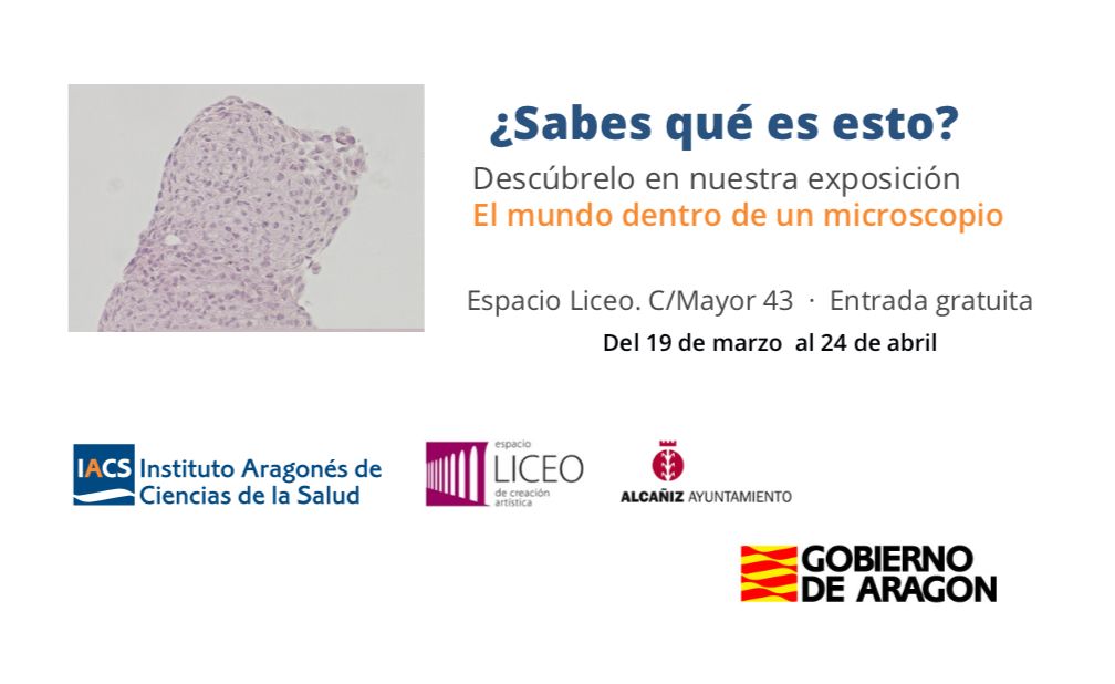 La exposición El mundo dentro de un microscopio encara sus últimos días en Alcañiz