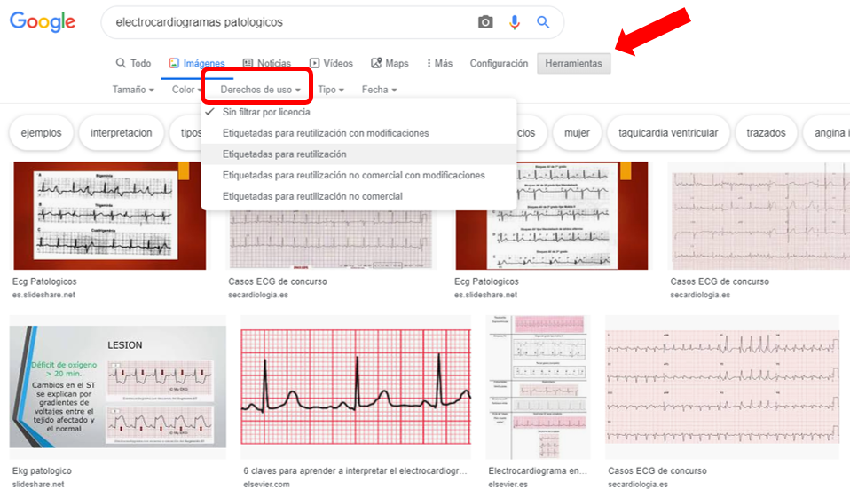 electrocardio
