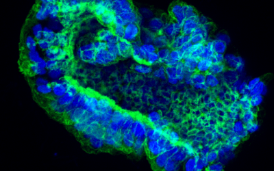 Cinco pasos clave en inmunofluorescencia