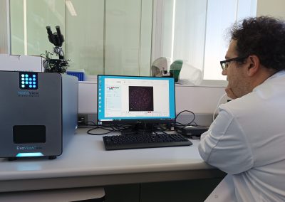 Personal del SCT Separación Celular y Citometría con el equipo ExoView™ R200: caracterización completa de vesículas extracelulares