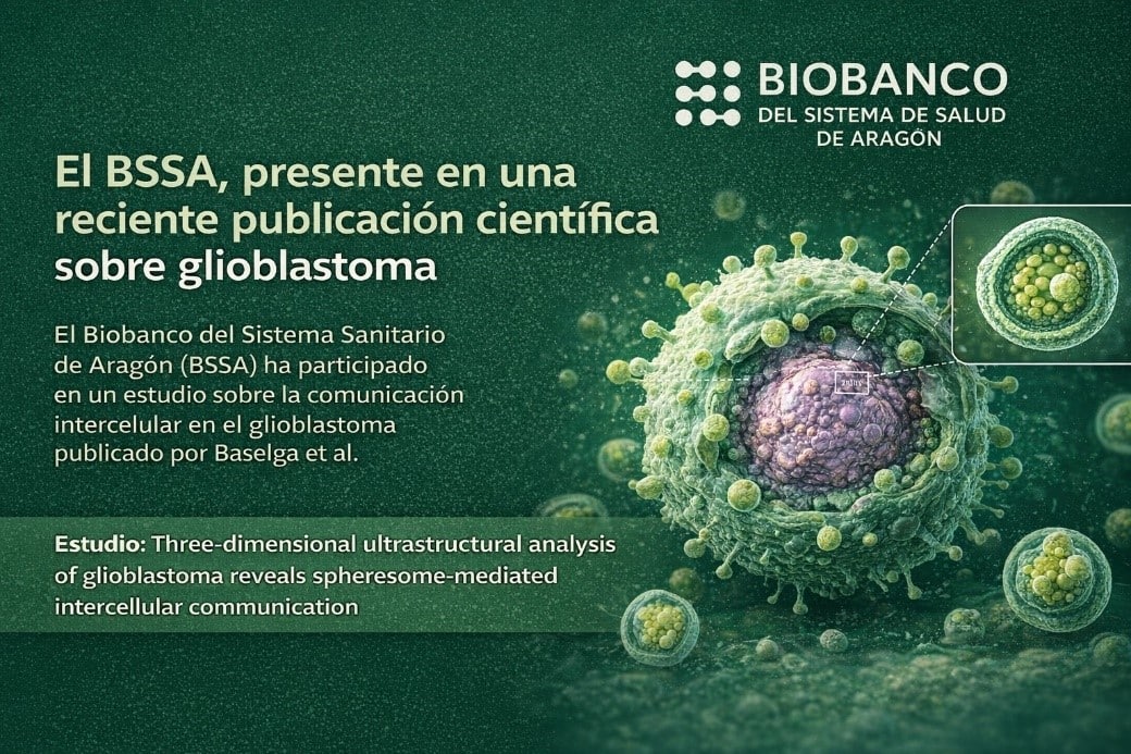 El BSSA, presente en una reciente publicación científica sobre glioblastoma