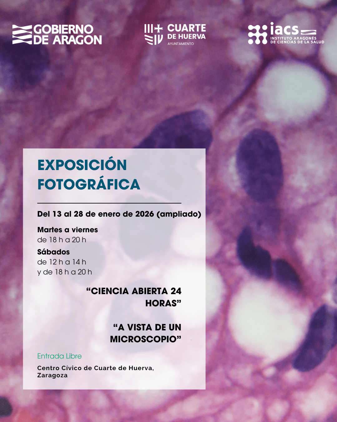 Cartel exposición: Del 13 al 28 de enero (plazo ampliado), podrás visitar la exposición fotográfica “Ciencia abierta 24 horas” y “A vista de microscopio” del Instituto Aragonés de Ciencias de la Salud (IACS), en el Centro Cívico de Cuarte de Huerva (Zaragoza).