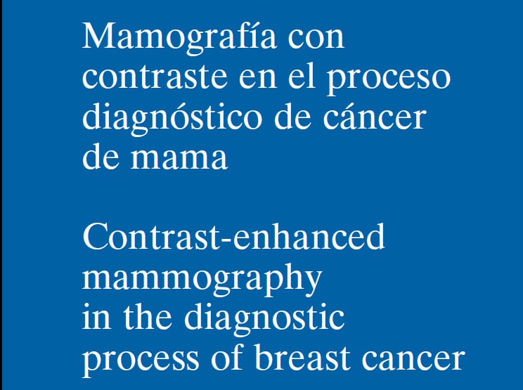 El IACS analiza en un informe de evaluación de tecnologías sanitarias la mamografía con contraste en el proceso diagnóstico de cáncer de mama