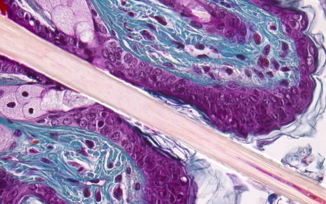 TRICROMICO DE MALLORY (40x)